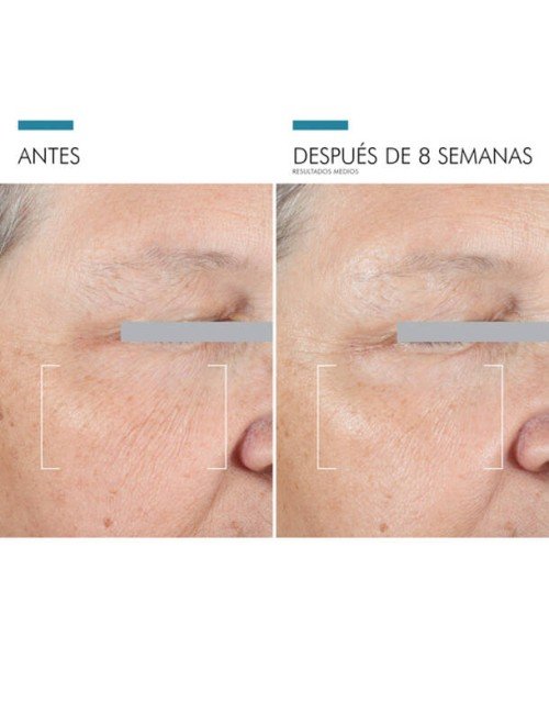 A.G.E EYE ADVANCED 15 ML