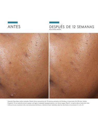 PHYTO A BRIGHTENING TREATMENT 30ML