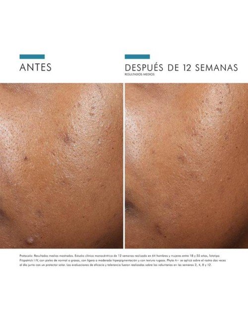 PHYTO A BRIGHTENING TREATMENT 30ML