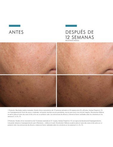 DISCOLORATION DEFENSE SERUM